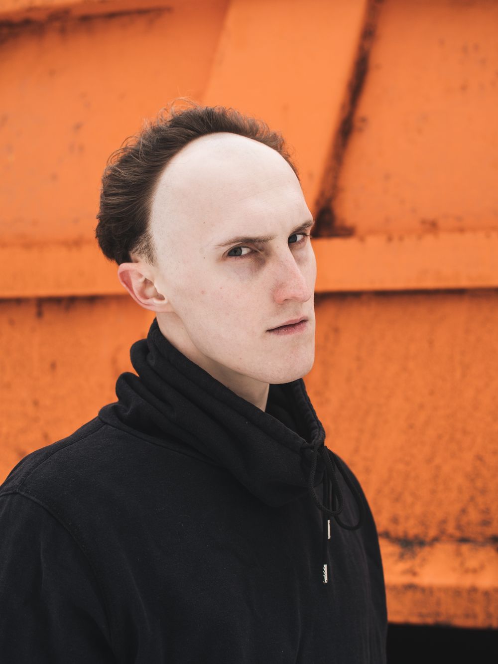 side profile of man with short crop and receding hairline