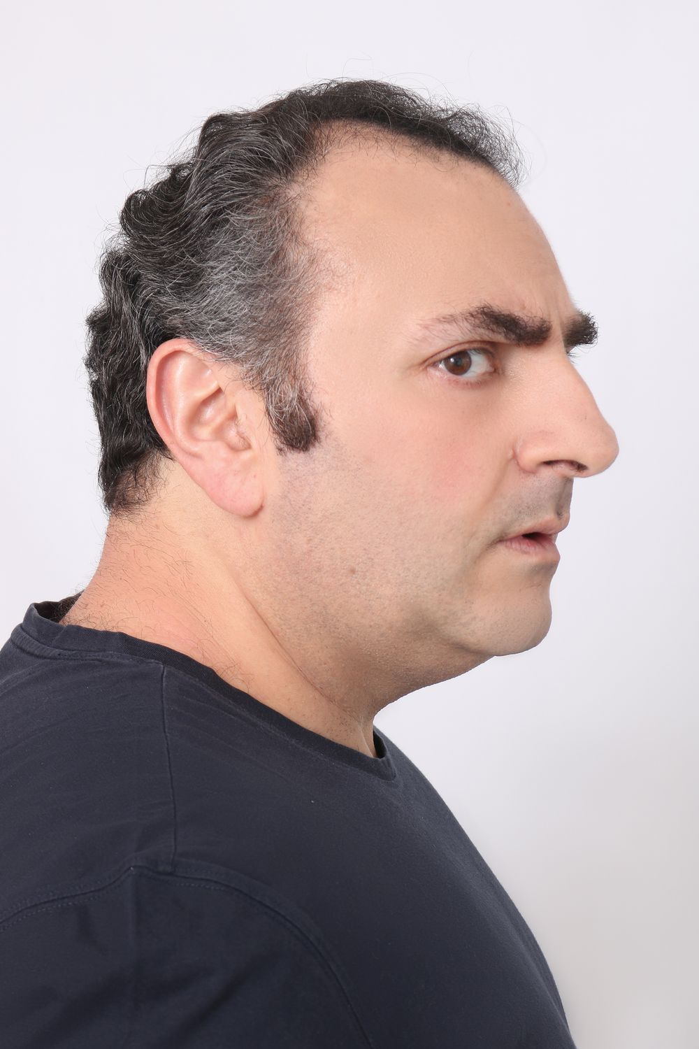 side profile of man with receding hairline and short side part