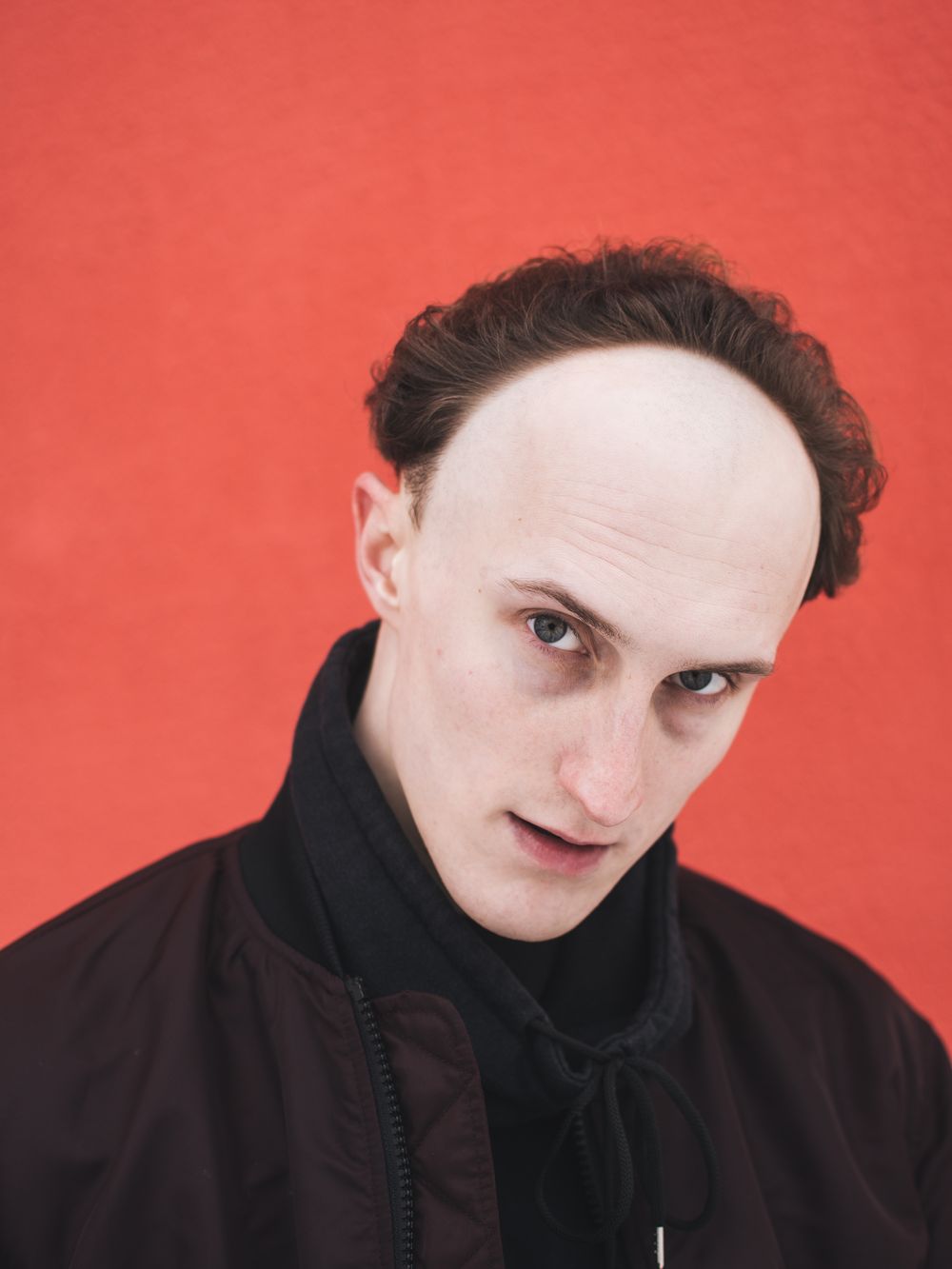 man with swept back hairstyle and visible receding hairline